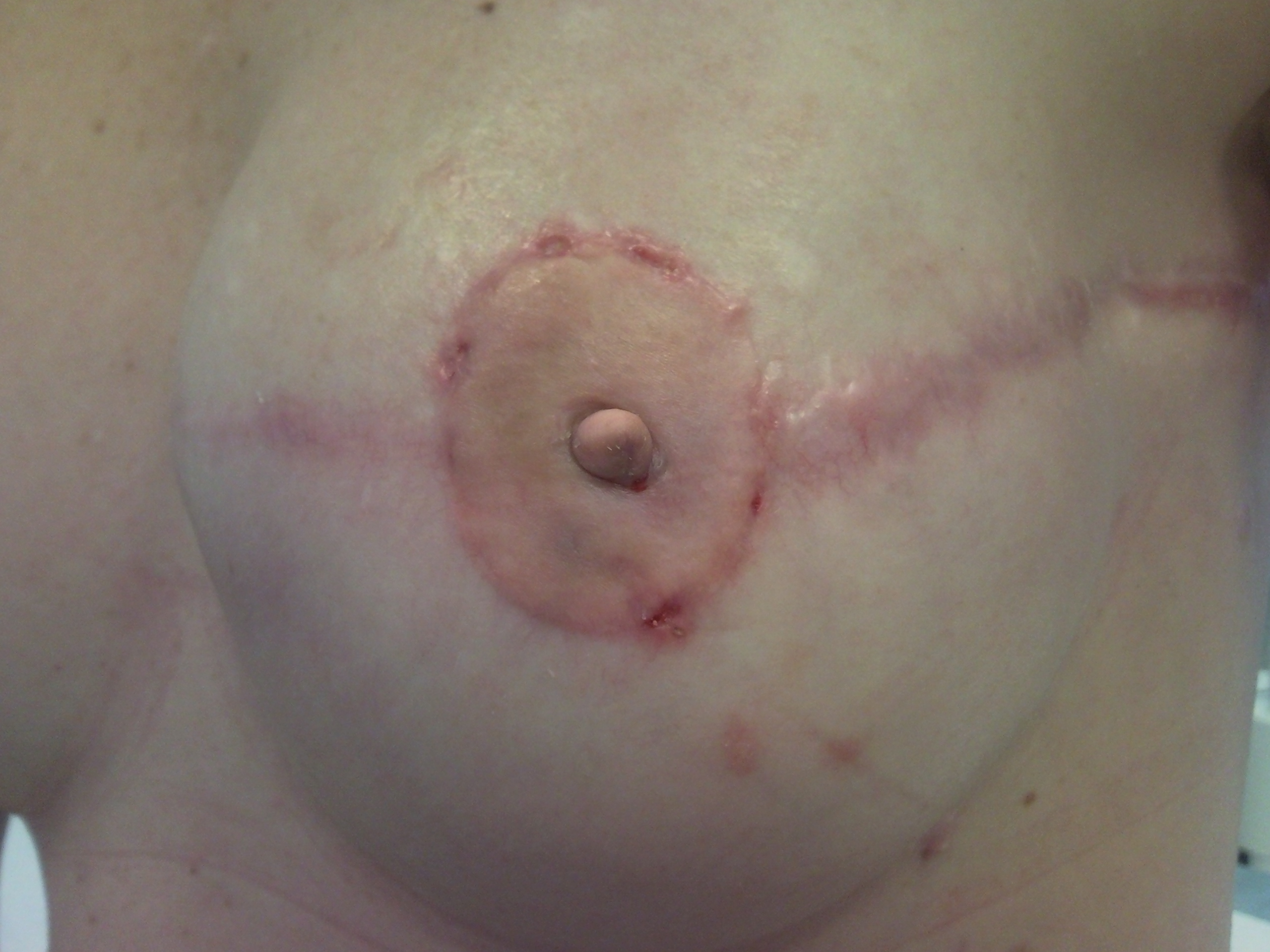 фото сосков груди при беременности на ранних сроках фото 114